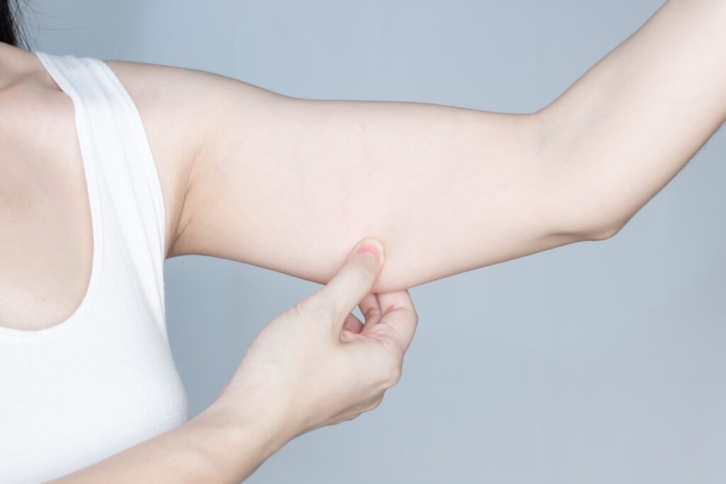 ดูดไขมันต้นแขน บอกลาแขนใหญ่ ราคาเท่าไหร่ เตรียมตัวอย่างไร [2024]