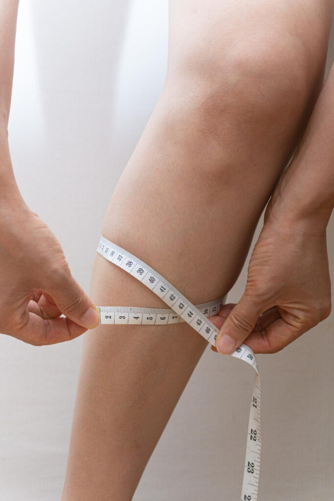 การดูดไขมันน่อง ช่วยกำจัดไขมันส่วนเกินในบริเวณน่อง ช่วยให้ขนาดของน่องลดลง และขาดูเรียวขึ้น