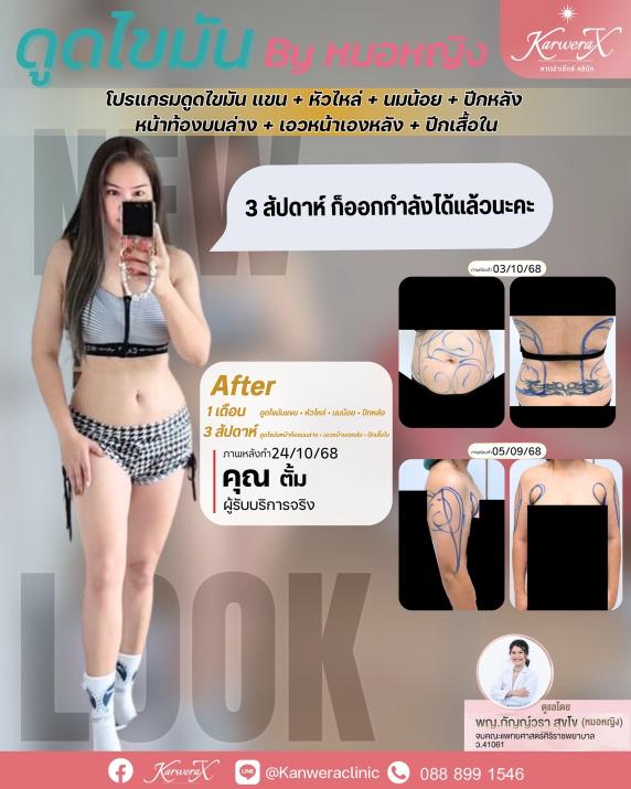 1578a6b91221633f2cb1341b1e97523f20b43099