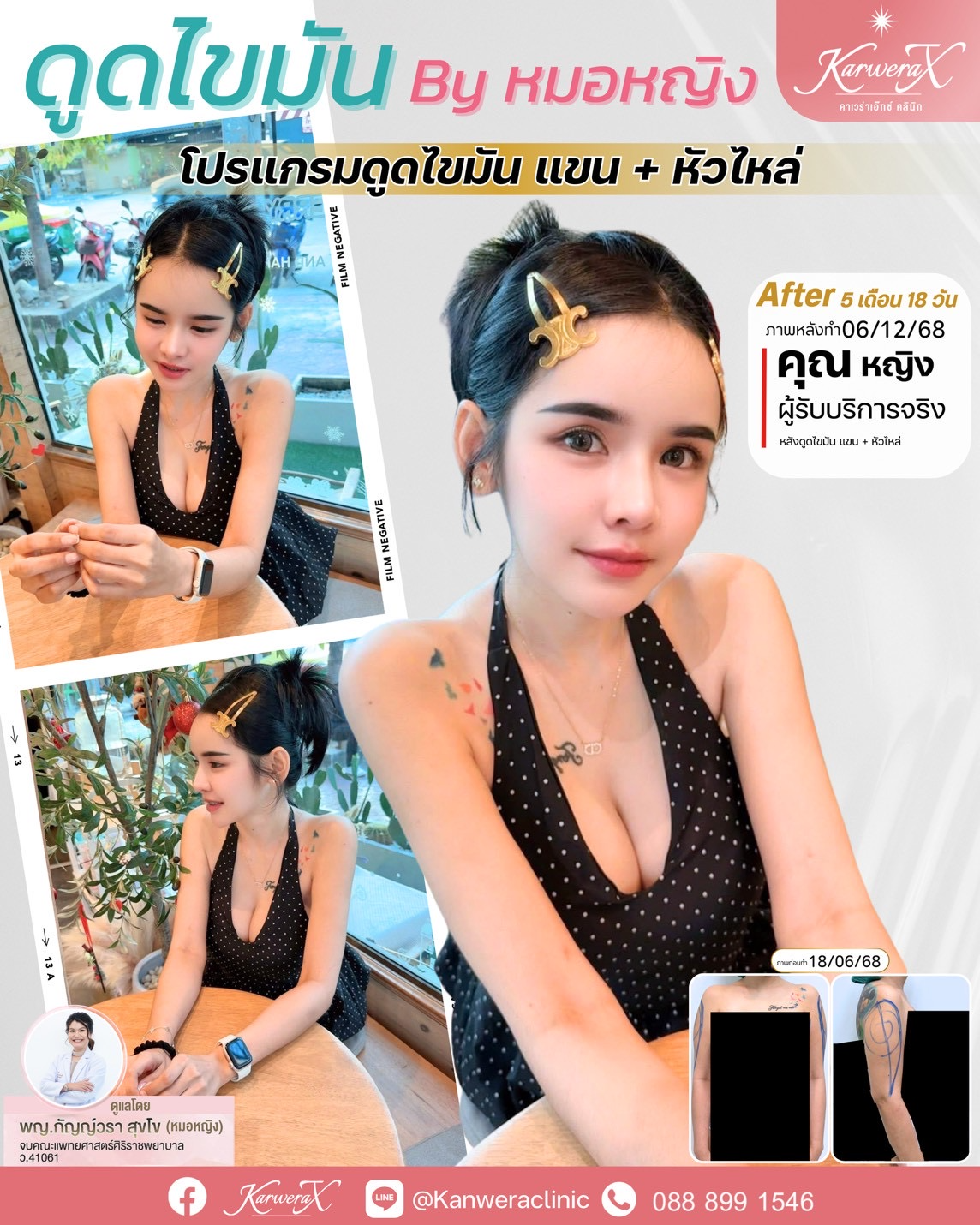 58d0fd753e74d97e46f204067d515a418ba556dc