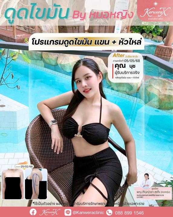 a78e4c40ab4280e1422a15d7a8b81386833b1add